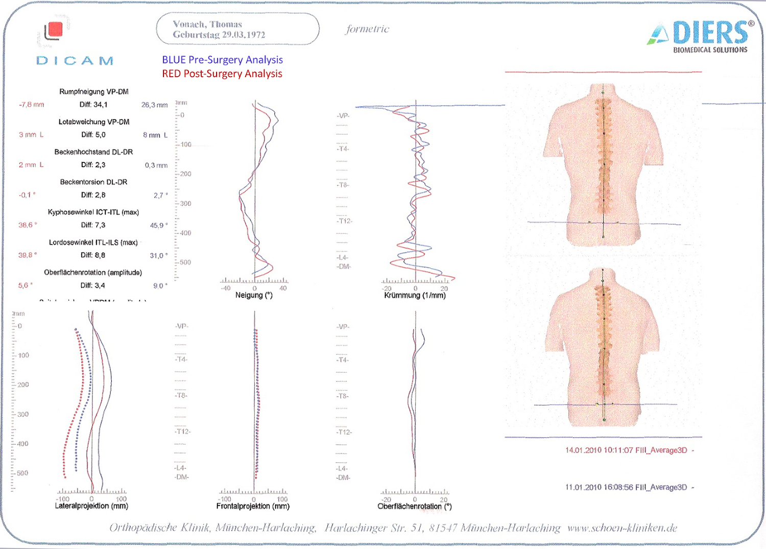 Spine_Details-ComparissonProPost Surgery_Thomas J. Vonach.jpg