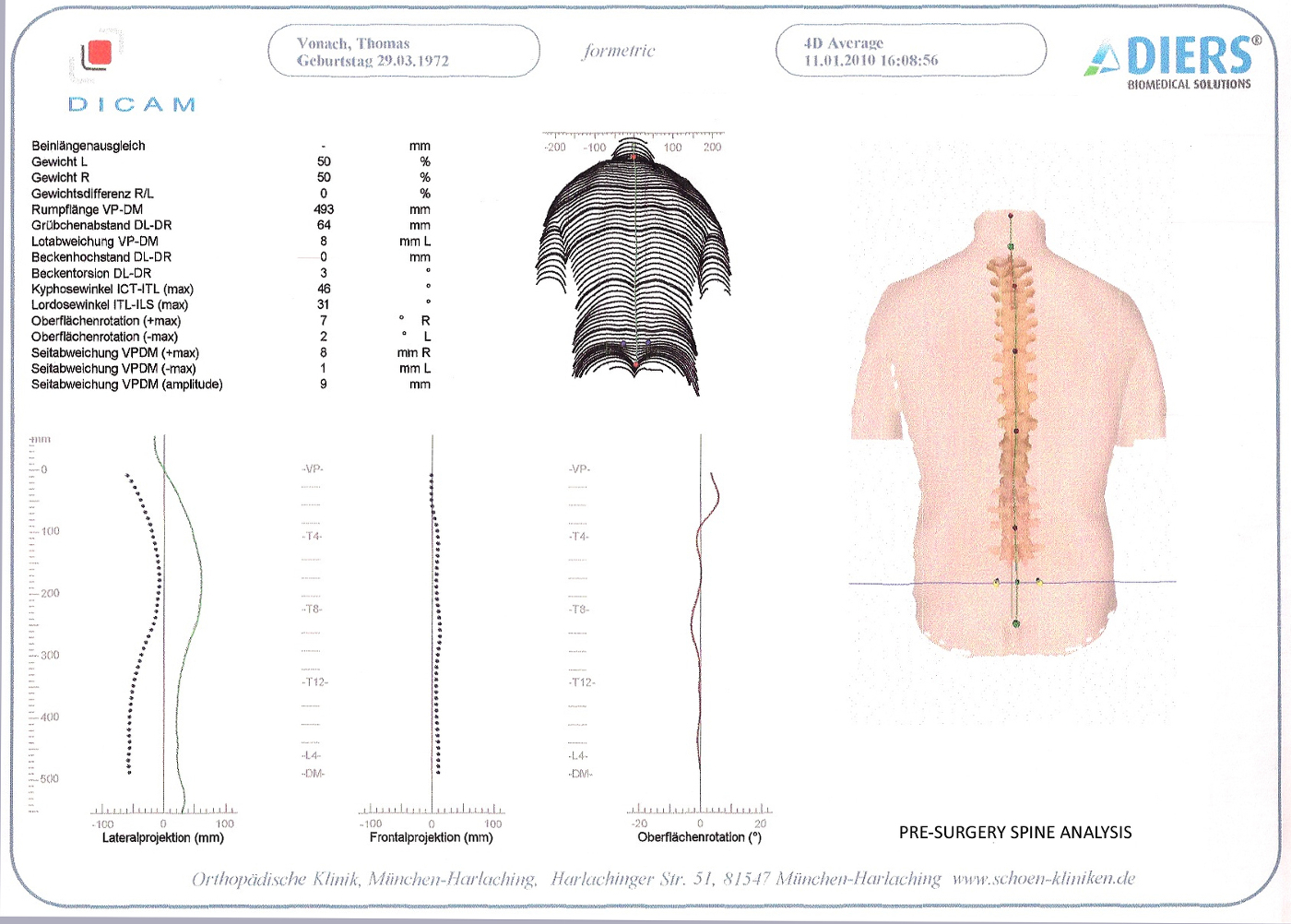 Spine_Details Pre- Surgery_Thomas J. Vonach.jpg